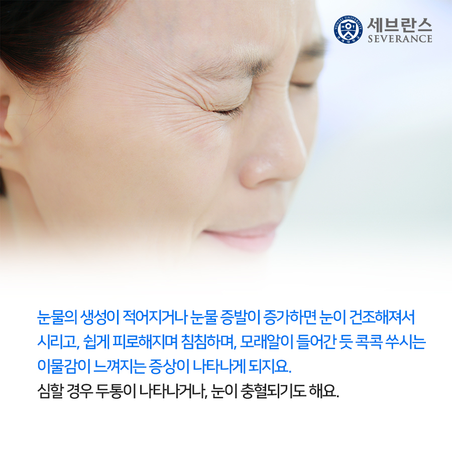 눈물의 생성이 적어지거나 눈물 증발이 증가하면 눈이 건조해져서 시리고, 쉽게 피로해지며 침침하며, 모래알이 들어간 듯 콕콕 쑤시는 이물감이 느껴지는 증상이 나타나게 되지요. 심할 경우 두통이 나타나거나, 눈이 충혈되기도 해요.